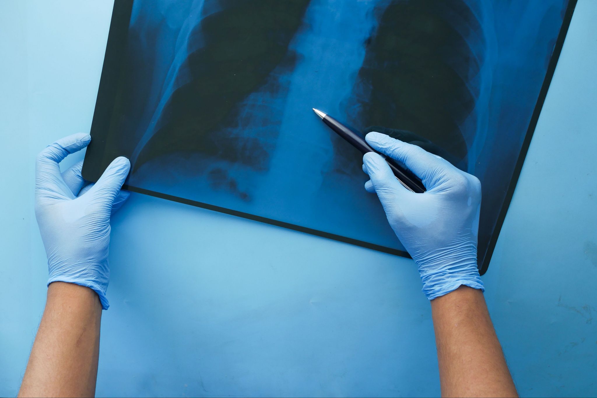 Medical Image